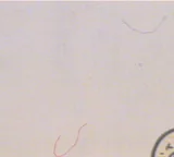 Detalle de seguridad 8